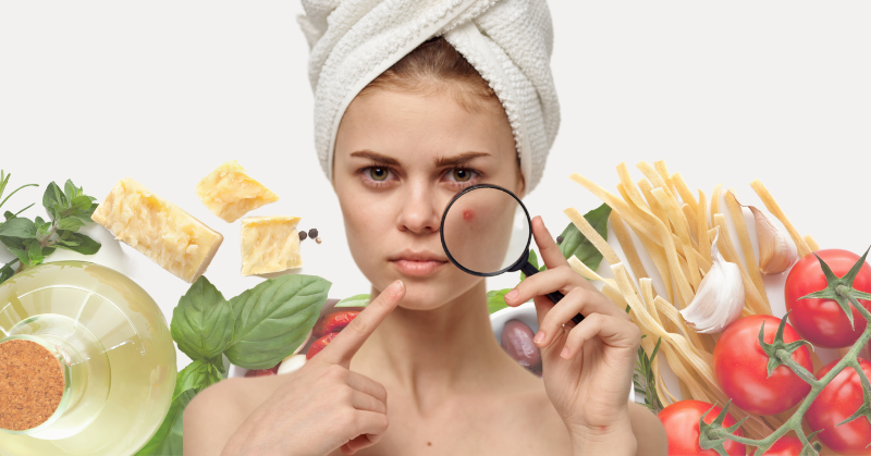 Achieve Clear, Radiant Skin: The Connection between Acne-Prone Skin and Diet