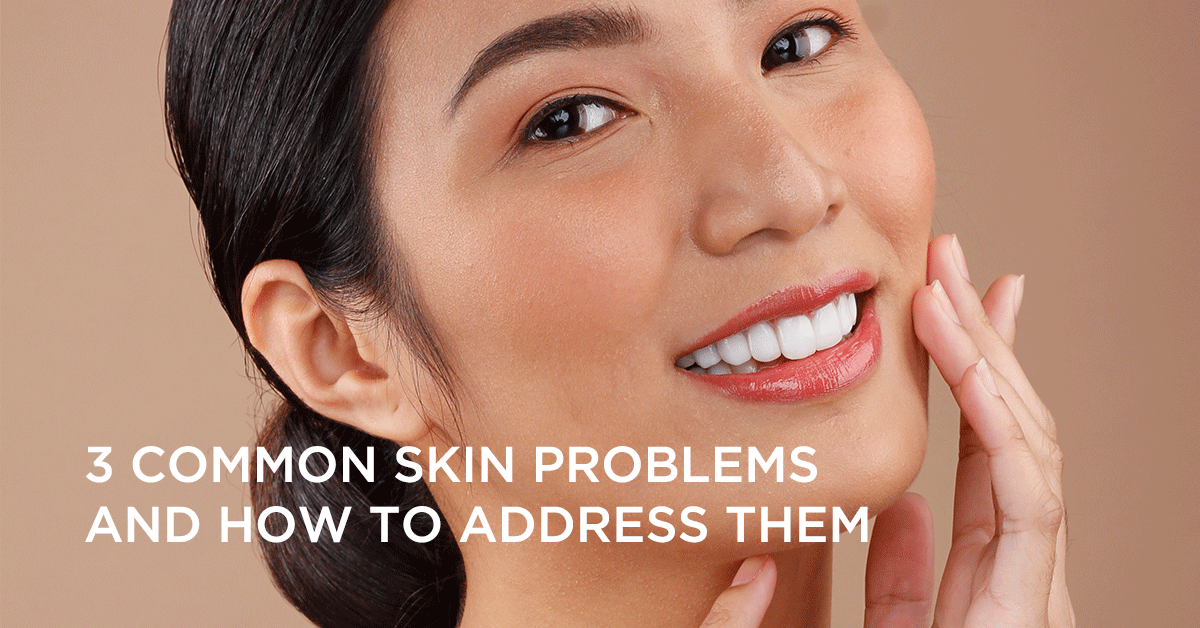 3 Common Skin Problems and How To Address Them